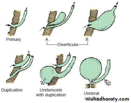 Vesicoureteral Reflux