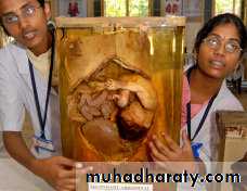 Ectopic pregnancy