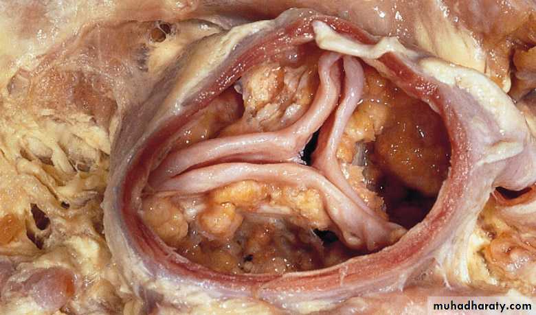 Cardiovascular system CVS