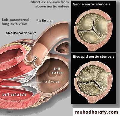 Cardiovascular system CVS