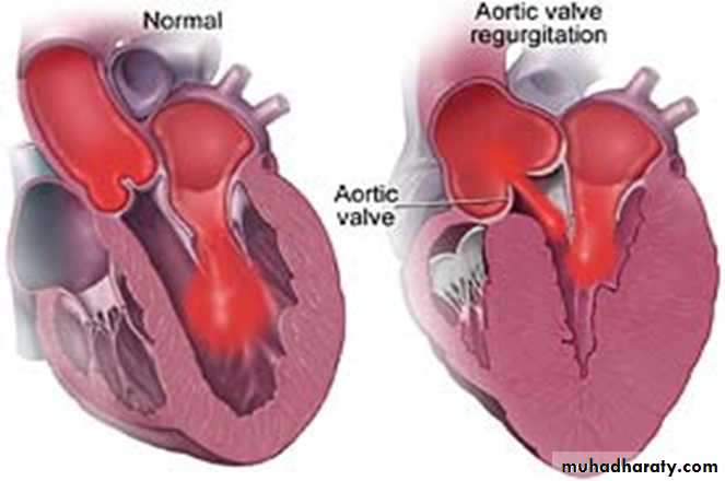 Cardiovascular system CVS