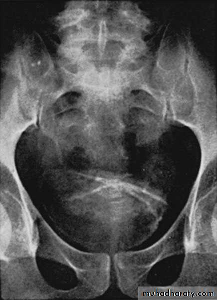 Urinary system