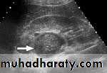 Urinary system