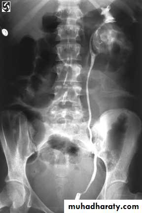 Urinary system
