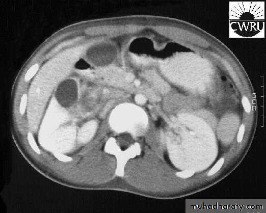 Urinary system