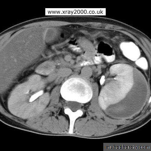 Urinary system