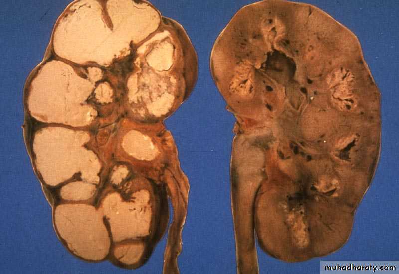 Urinary system