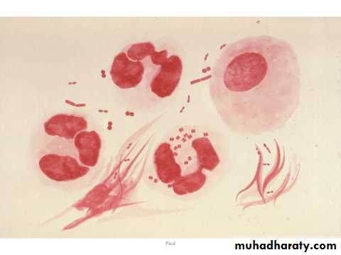 urethritis
