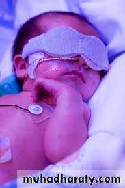 Hyperbilirubinemia in the new born