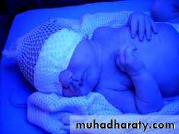 Hyperbilirubinemia in the new born