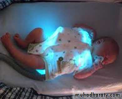 Hyperbilirubinemia in the new born