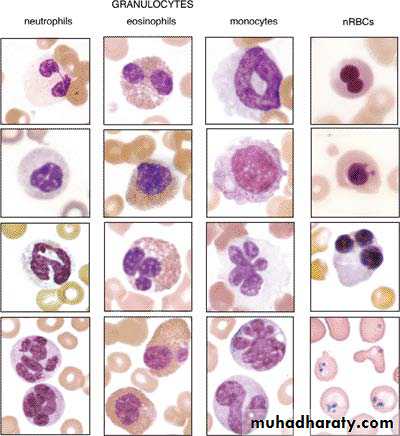 Aplastic anemia and anemia of chronic diseases