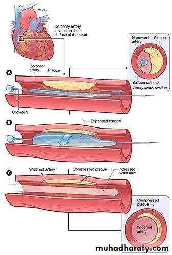 Enzymes