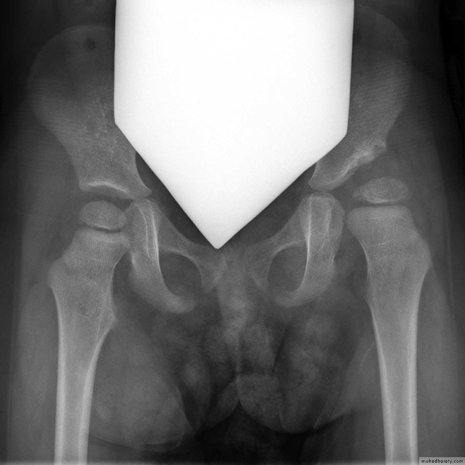Practical muscloskeletal