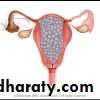 Gestational trophoblastic disease