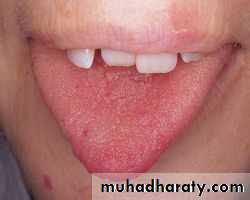 1.Thrombotic thrombocytopenic purpura