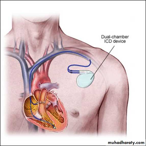 Cardiovascular system CVS