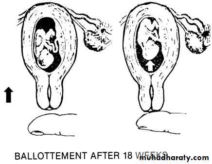 signs and symptoms of pregnancy