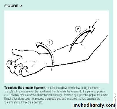 The Elbow