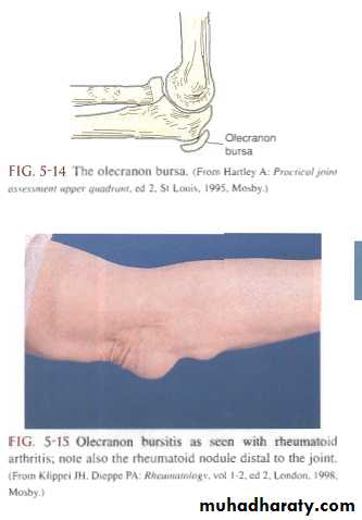 The Elbow