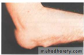 The Elbow