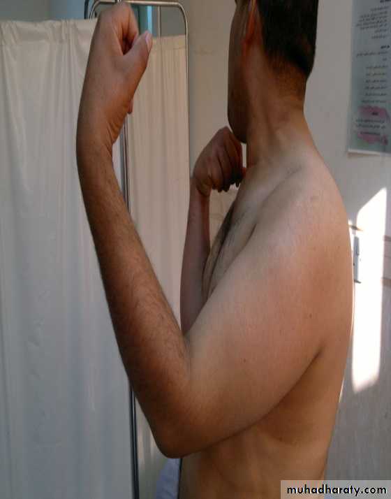 The Elbow
