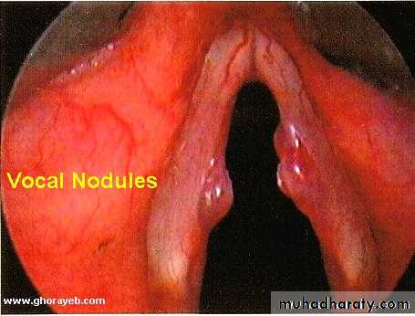 The larynx