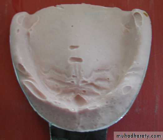 Complete denture
