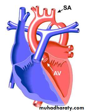 Acyanotic-Congenital-Heart-Disease