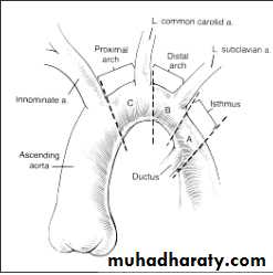 Acyanotic-Congenital-Heart-Disease