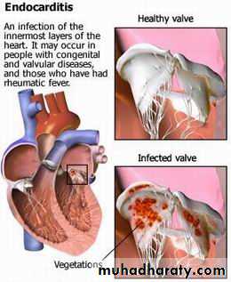 Heart Failure (HF)