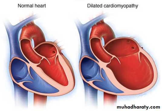 Heart Failure (HF)