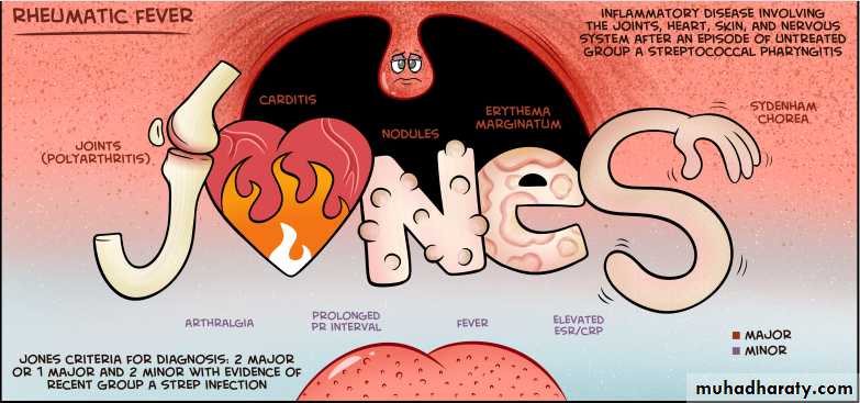 Heart Failure (HF)