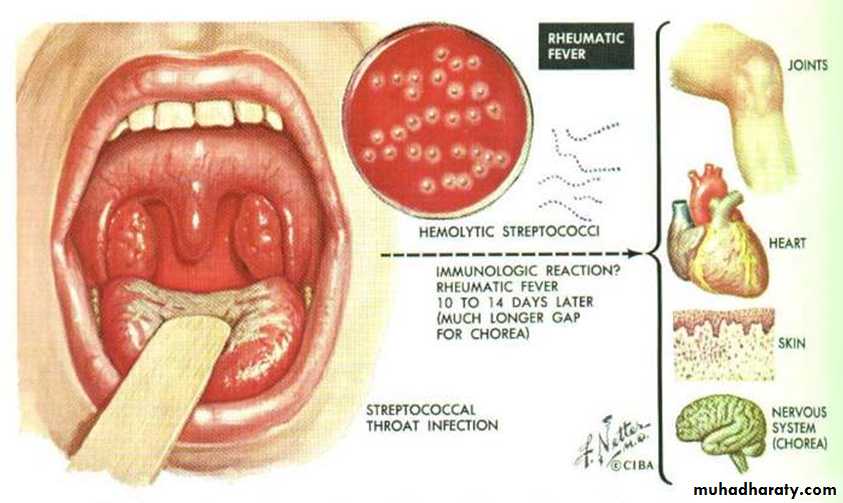Heart Failure (HF)