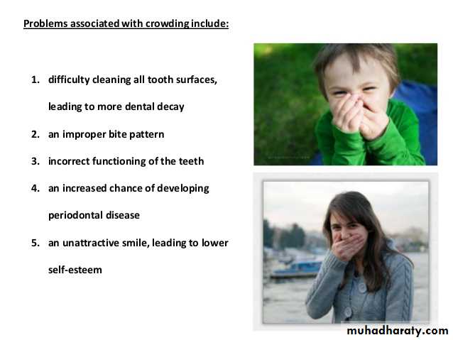 dental crowding and spacing