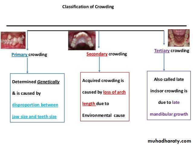 dental crowding and spacing