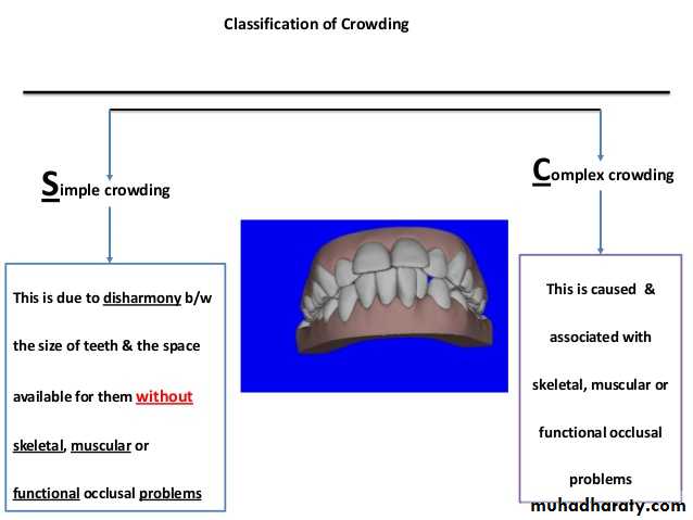 dental crowding and spacing