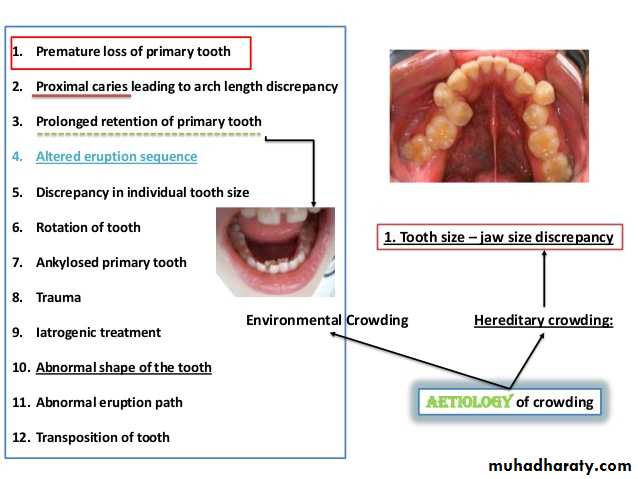 dental crowding and spacing
