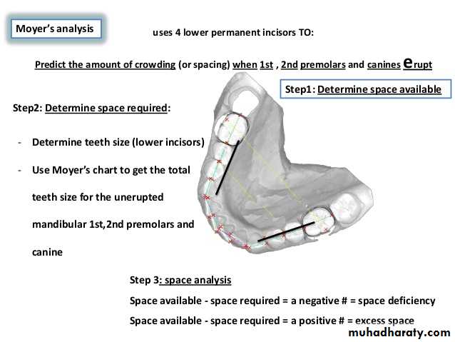 dental crowding and spacing
