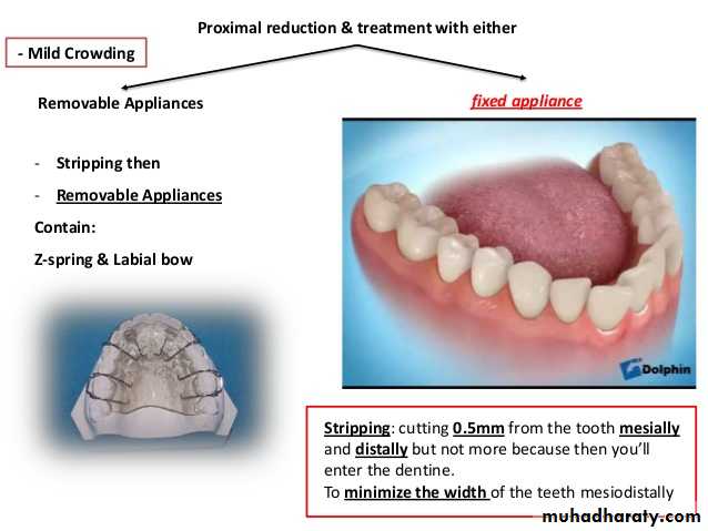dental crowding and spacing