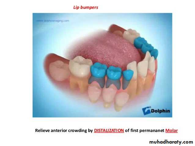 dental crowding and spacing