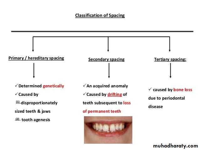 dental crowding and spacing