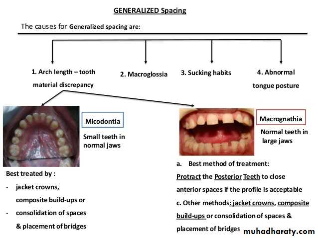 dental crowding and spacing