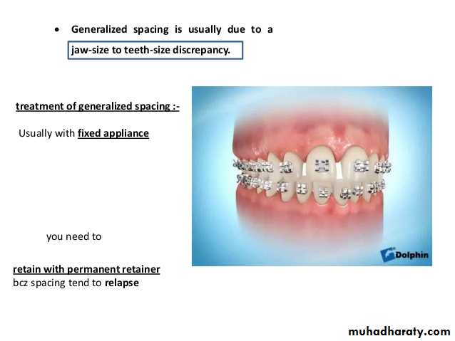 dental crowding and spacing