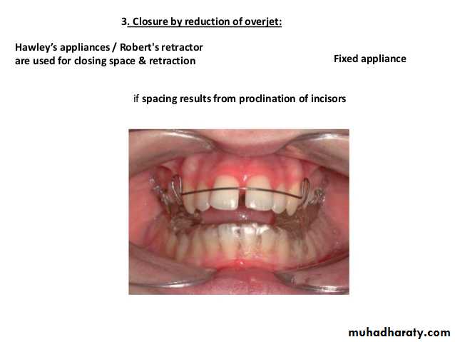 dental crowding and spacing