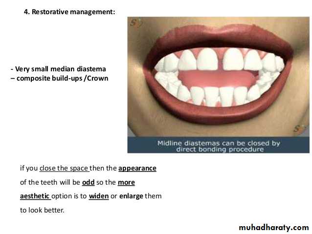 dental crowding and spacing