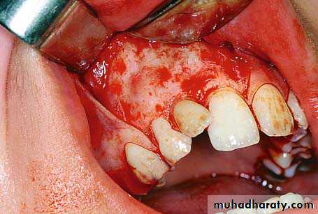 surgical aid to orthodonatic