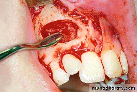 surgical aid to orthodonatic