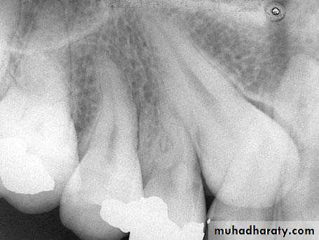 surgical aid to orthodonatic