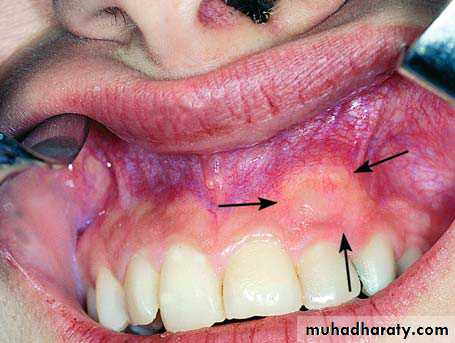 surgical aid to orthodonatic